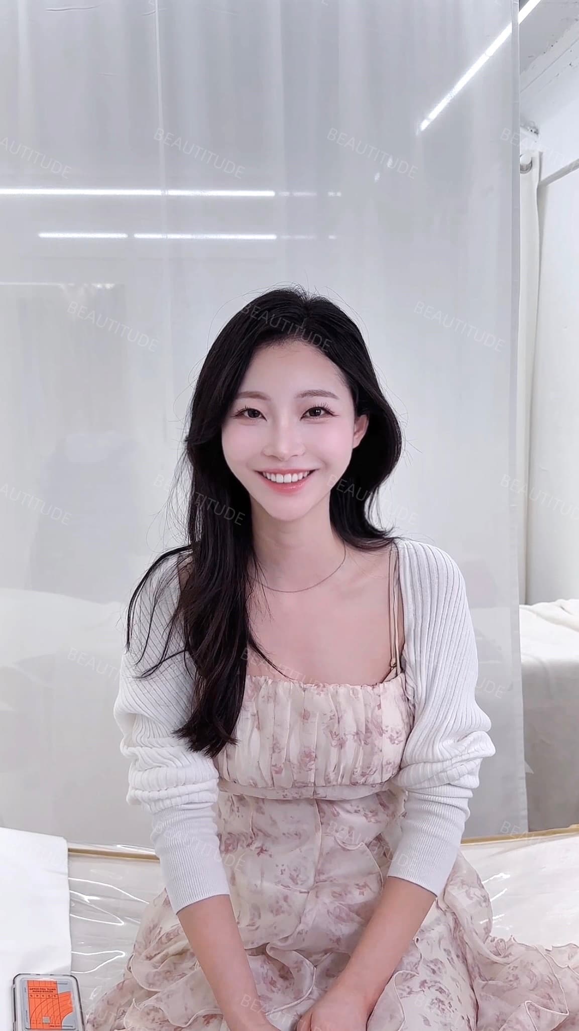 아나운서 김O람님의 헤어라인 시술 리얼 후기