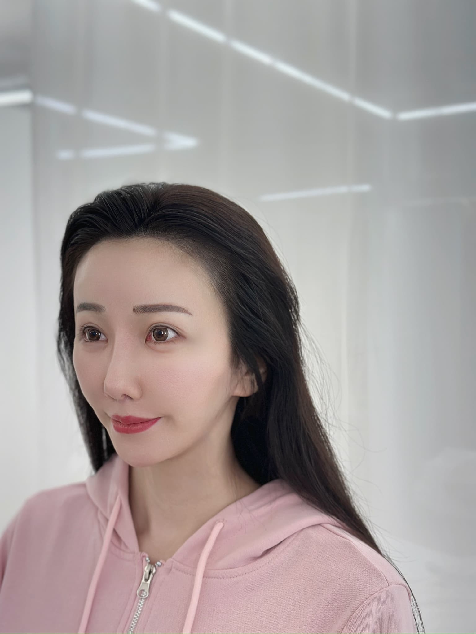 M 고객님의 자연스러운 헤어라인 반영구 시술 후기